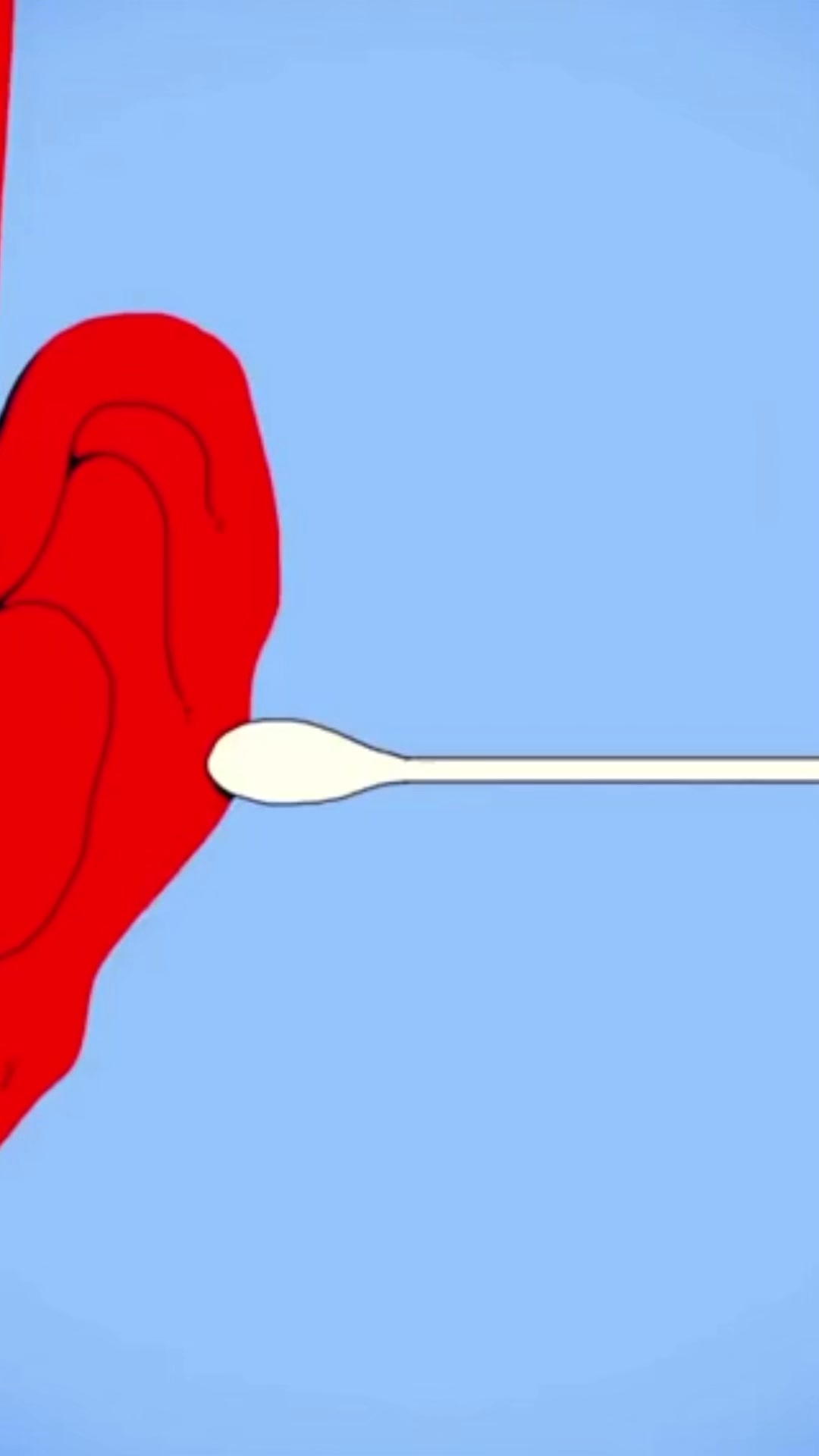 👀 Voyez ce qui se cache VRAIMENT dans vos oreilles