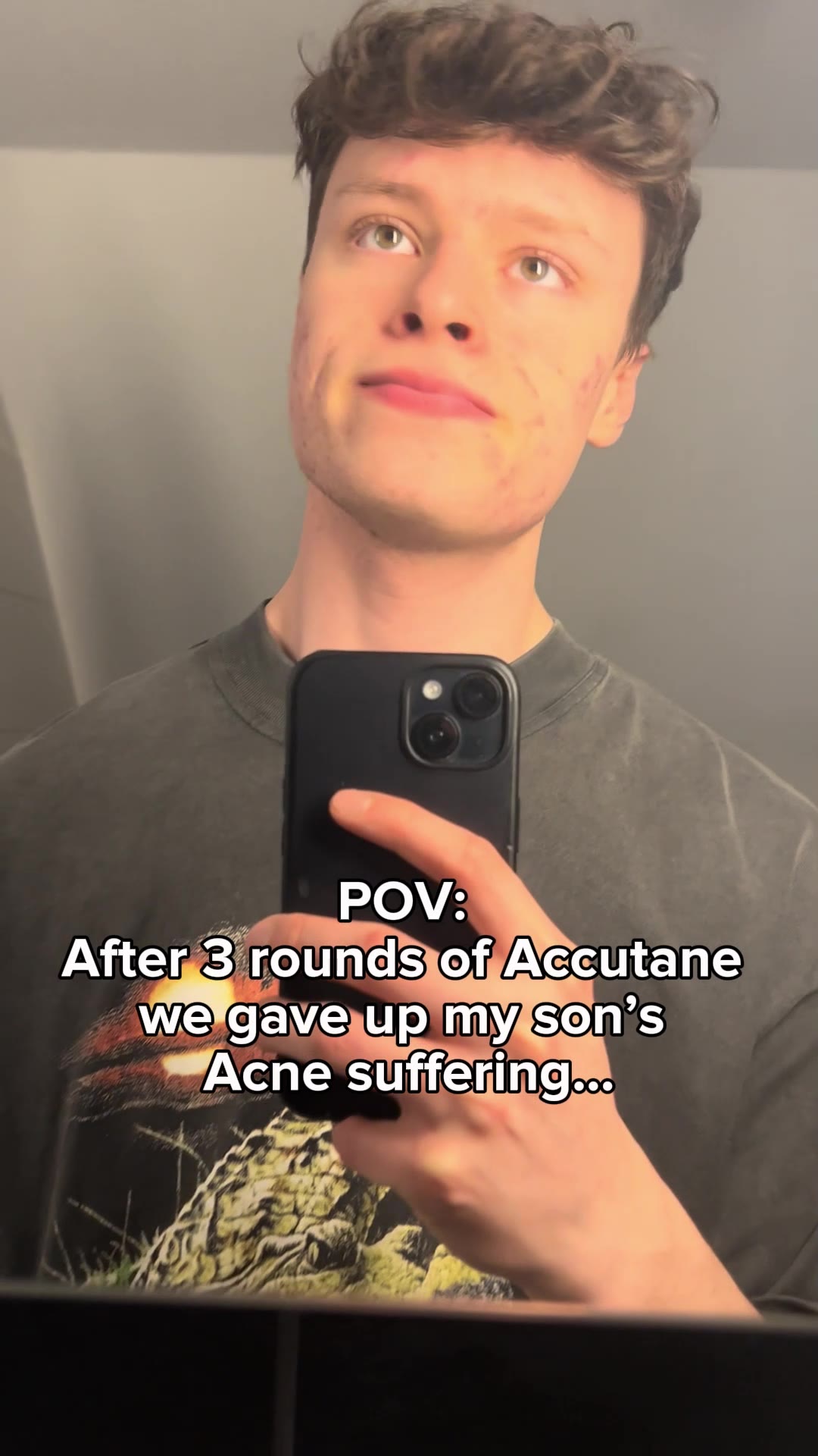#1 Teen Acne Fix