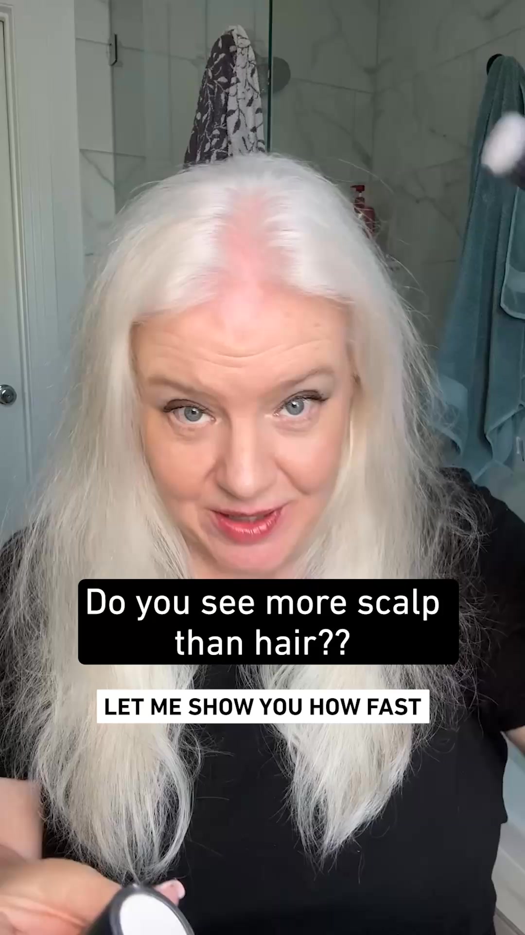 More Scalp Than Hair? Fix It Fast