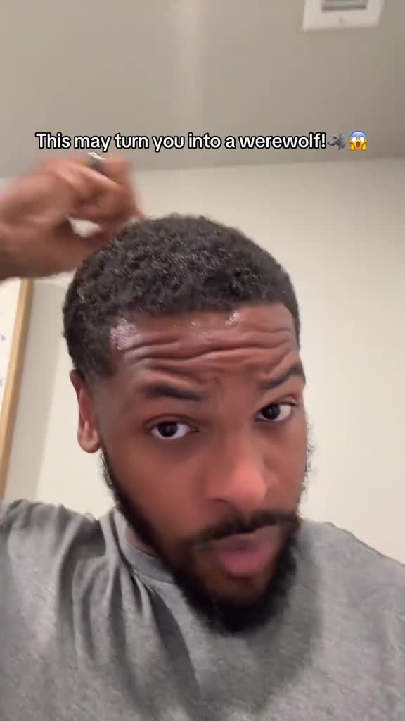 Hair thinning at the crown or temples?