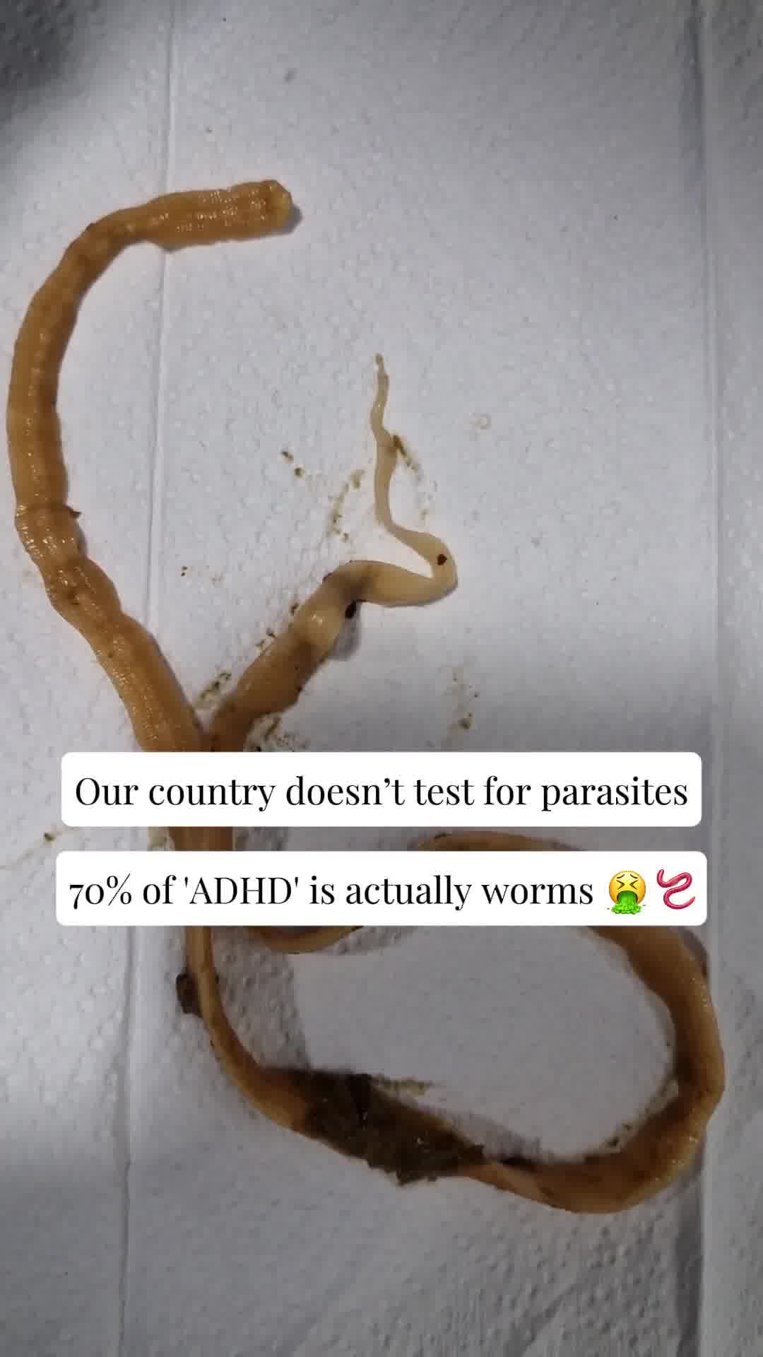 🪱 SAFE PARASITE CLEANSE 👉