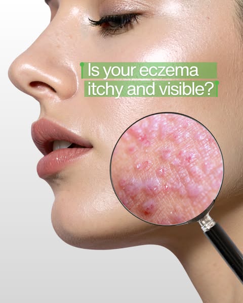 BodyWash for Eczema & More