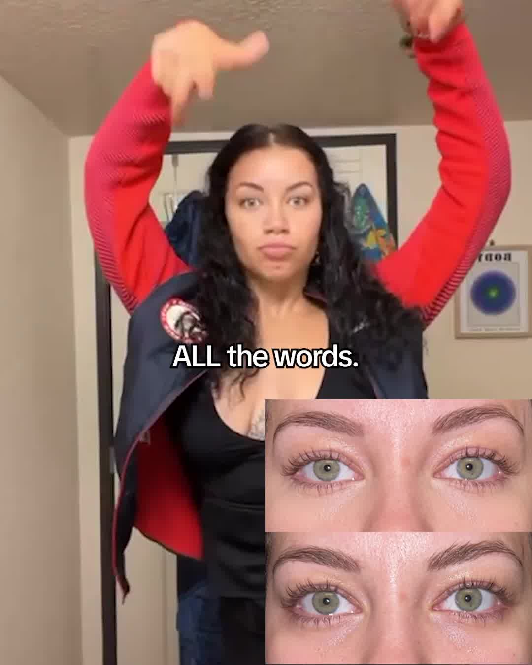 Who even gets filler anymore? 😏