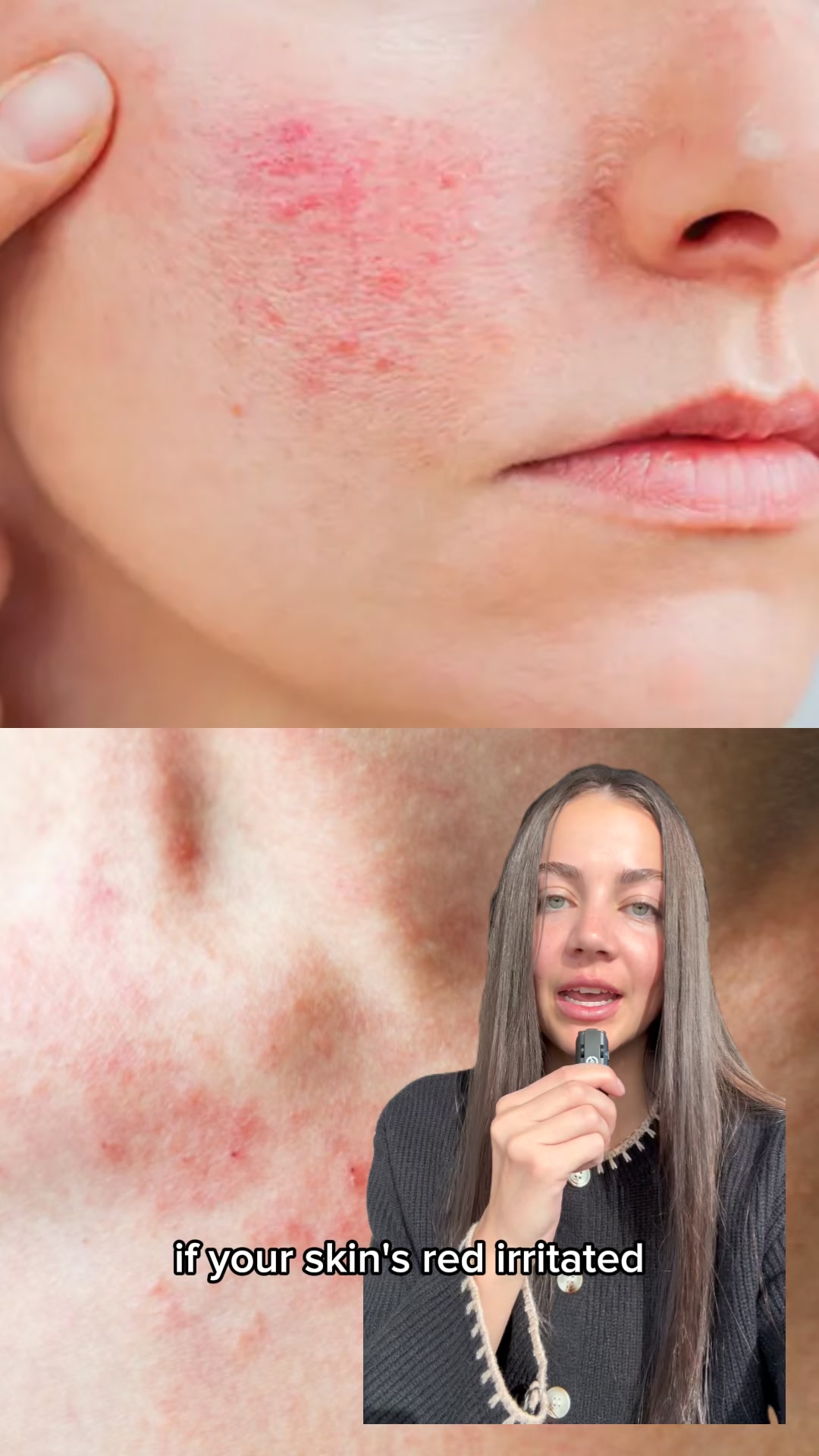 The Viral Tamanu Oil Serum