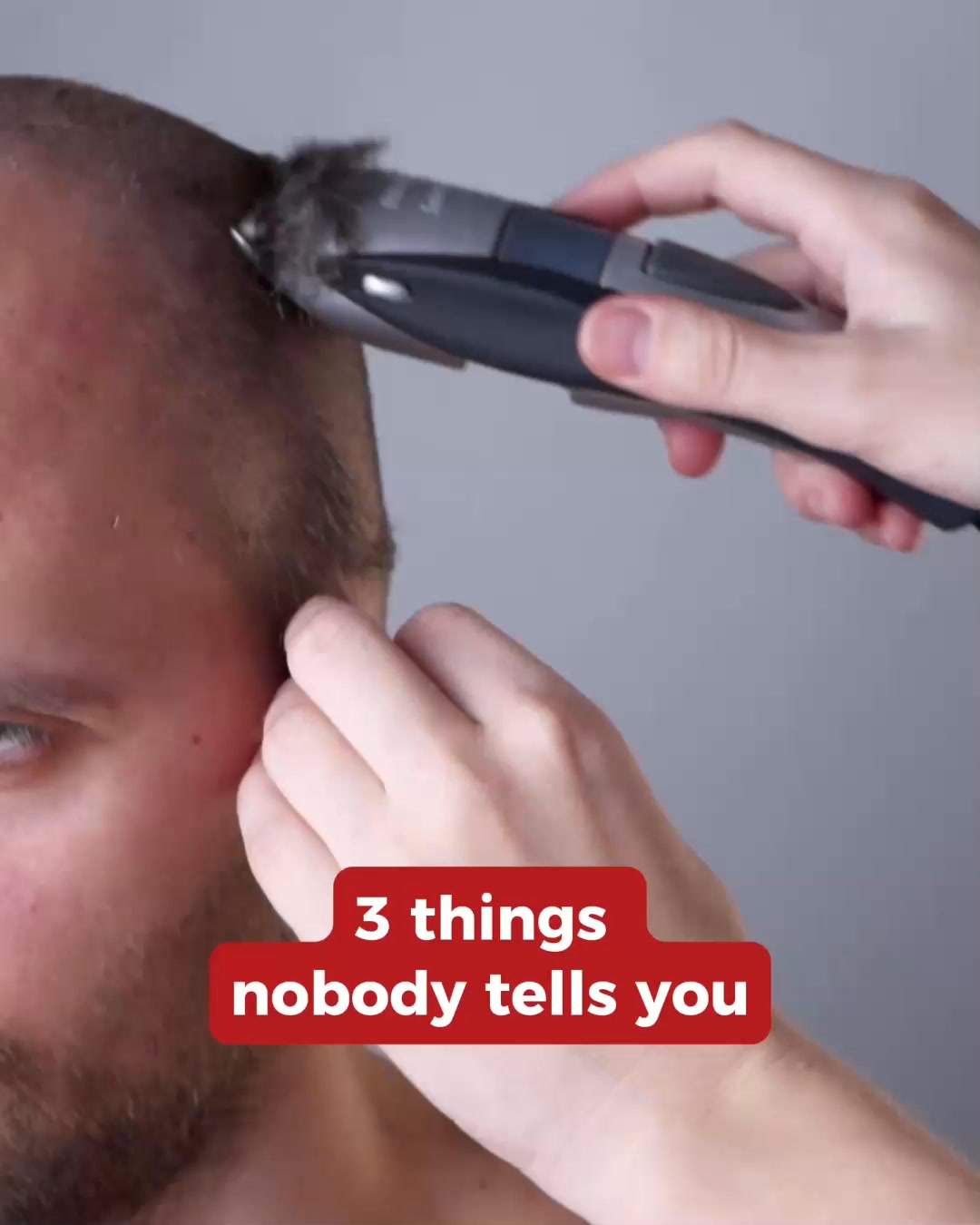 How To Stop & Reverse Hair Loss