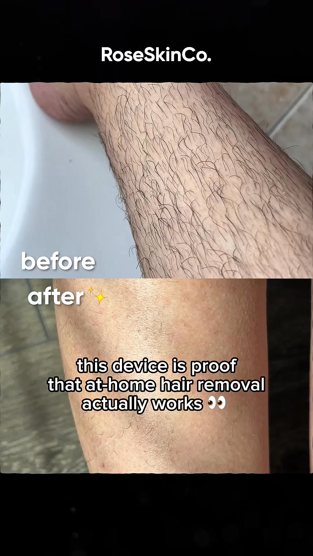 “Secret: I gave up waxing.”