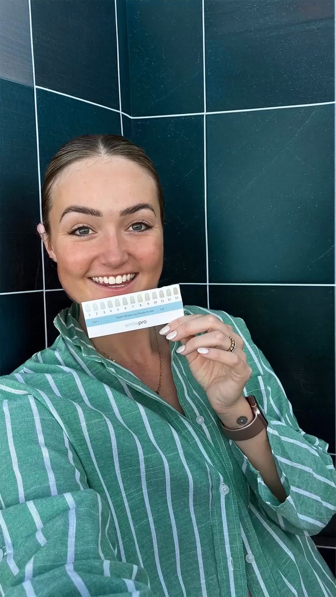 Dentist-Quality Whitening