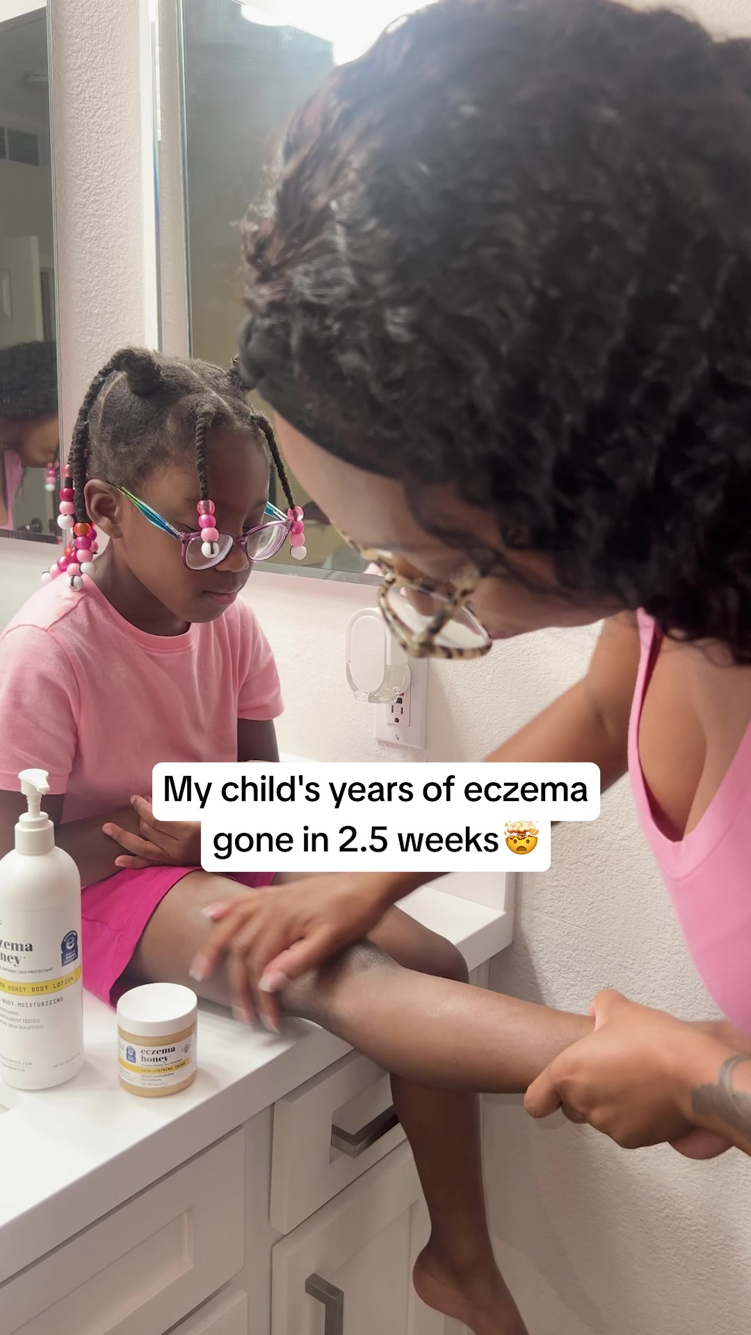 A Better Eczema Cream