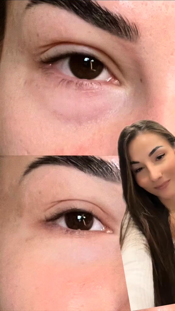 Conoce Espresso Eye Patches