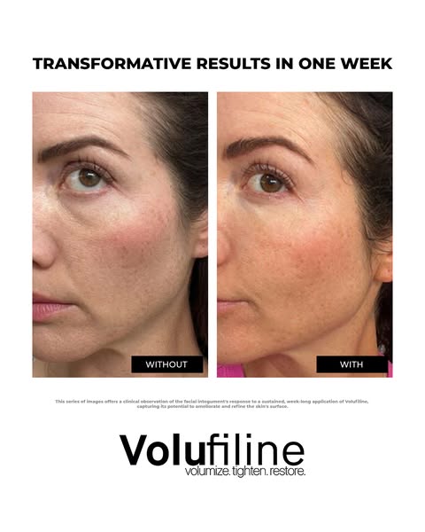 Get 30% OFF Today Only!