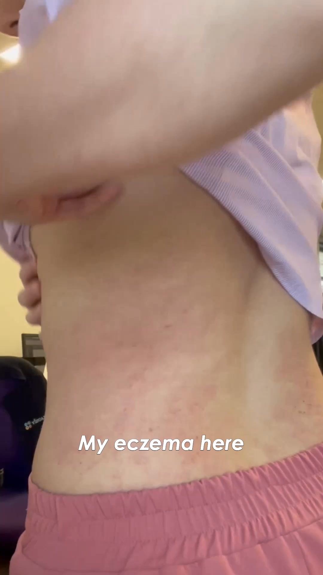 End the Struggle of Sore Skin for Good!