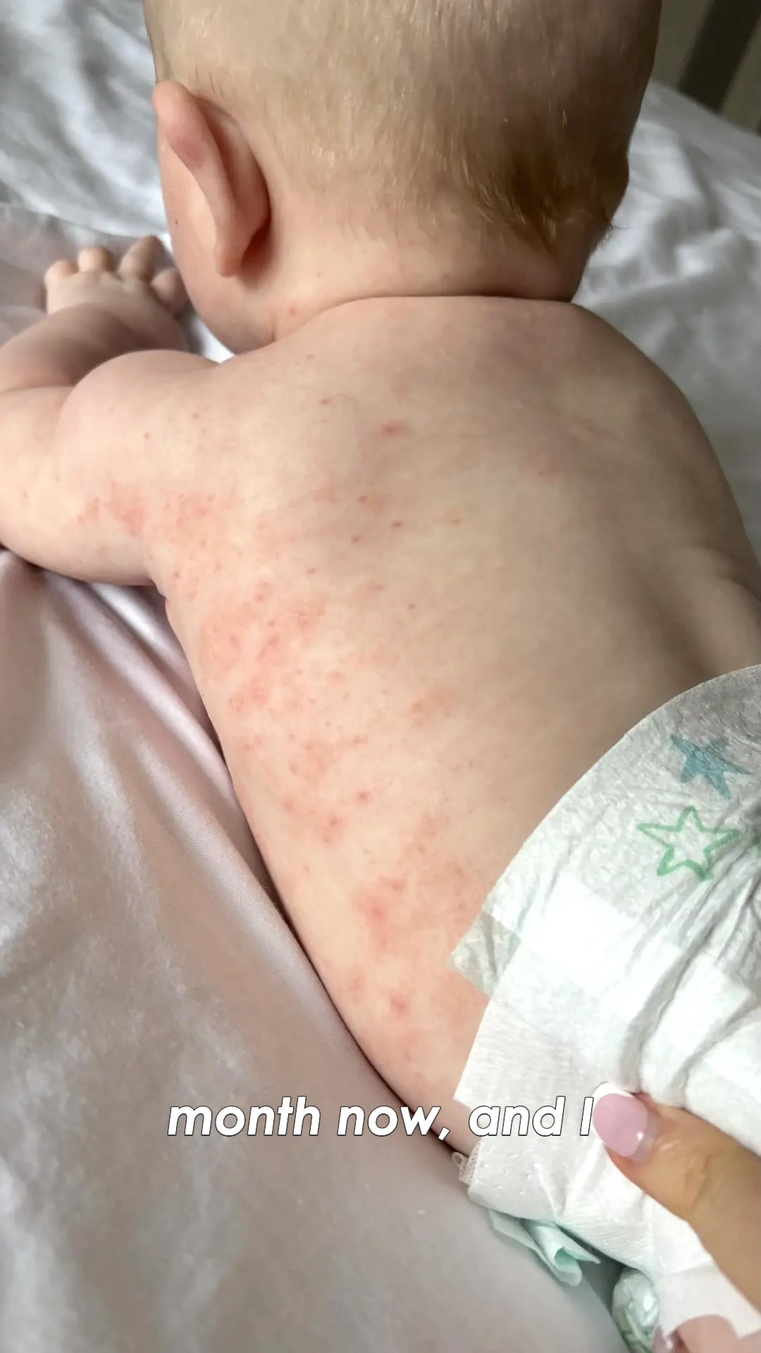 End the Struggle of Sore Skin for Good!