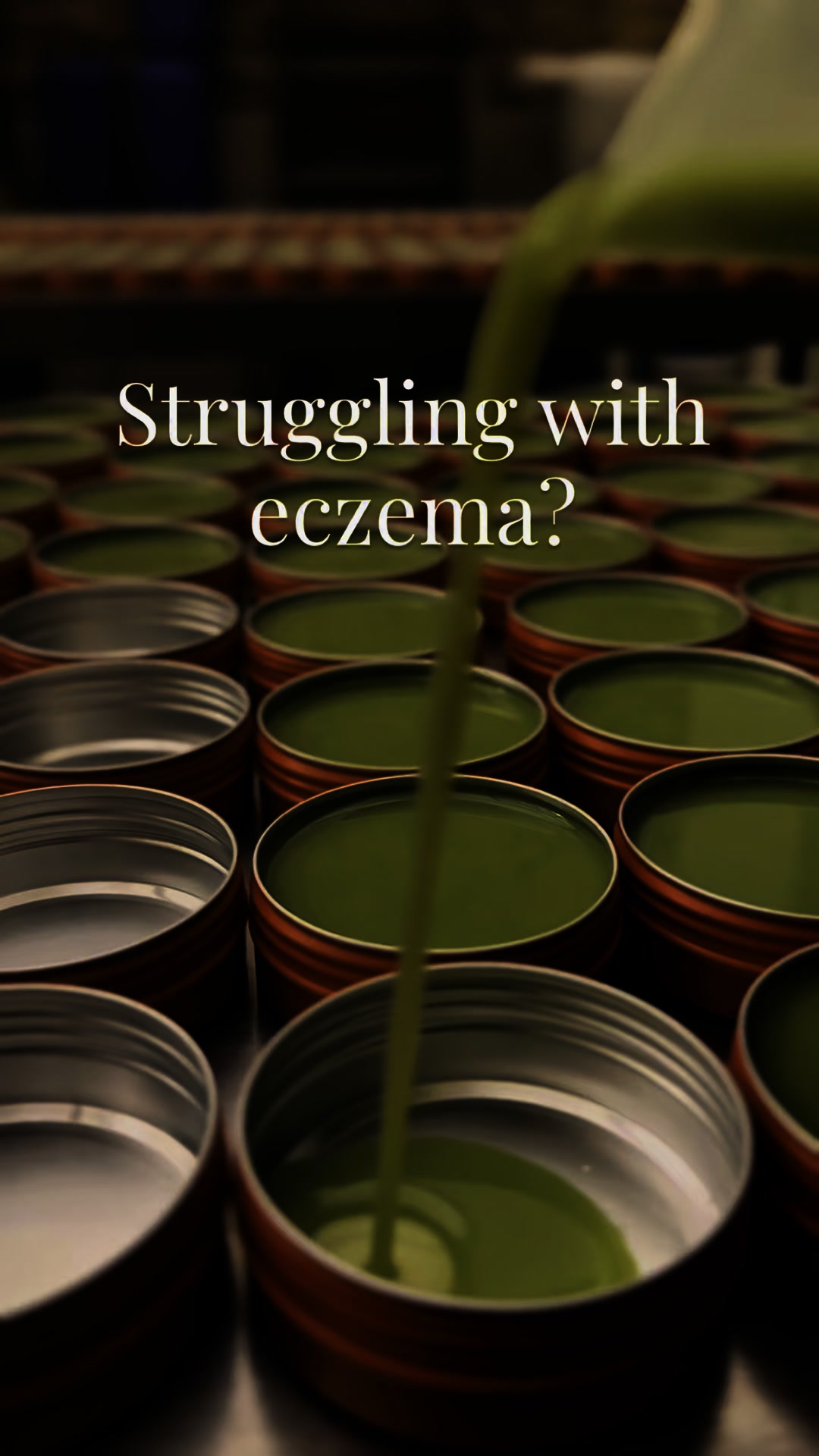 Natural relief for eczema