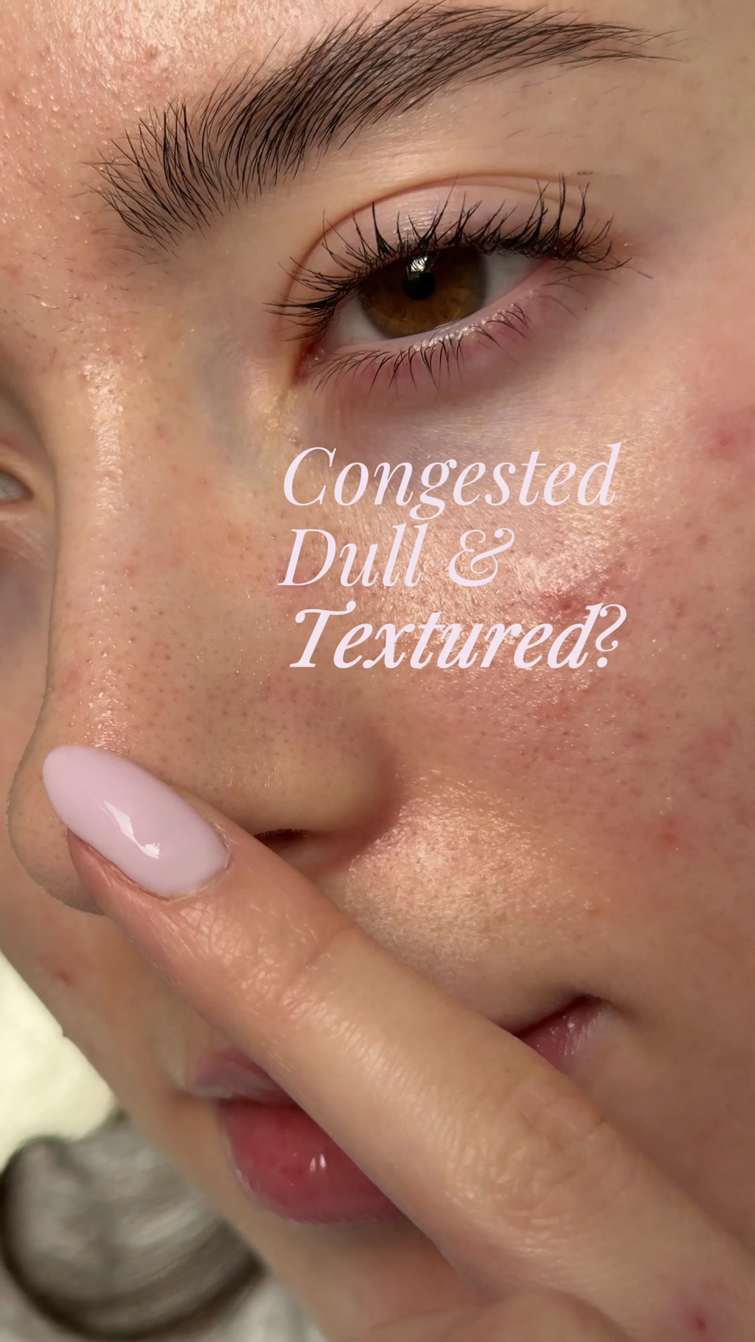 Exfoliation, done properly