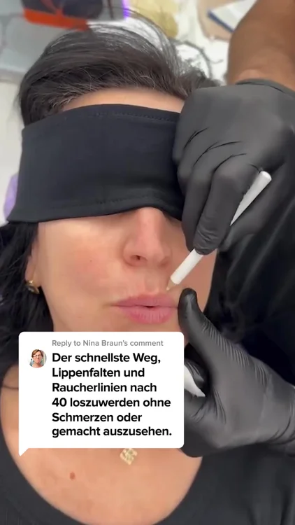 Hol dir deine Lippen in 2 Wochen zurück