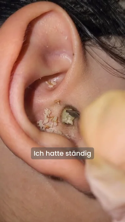 👂 Sichtbar reinigen statt raten
