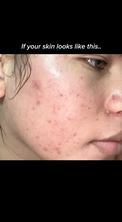 Repair you skin barrier with PINK ALOE 🎀