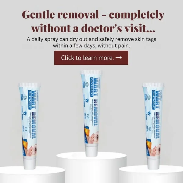 This wart bothered me for years - now it's gone (without a doctor!)