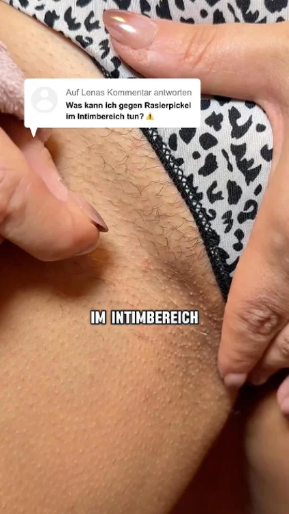 Sanft. Effektiv. Sichtbar.
